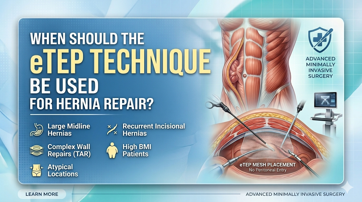eTEP TECHNIQUE FOR HERNIA REPAIR